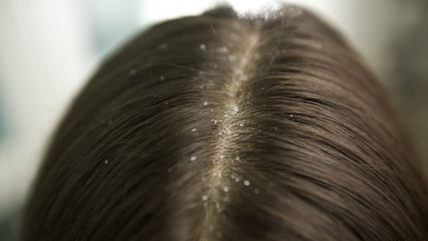 Exfoliating Hair And Scalp Treatment